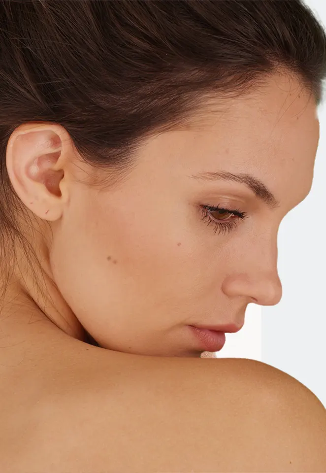 Anti-Wrinkle Injections Women Anti-Wrinkle Injections Women