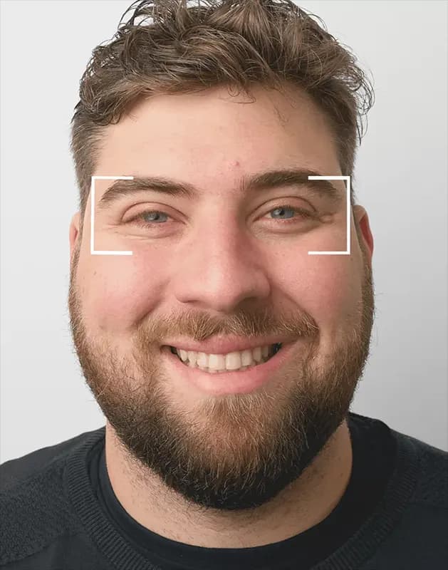 Crow's feet Crow's feet