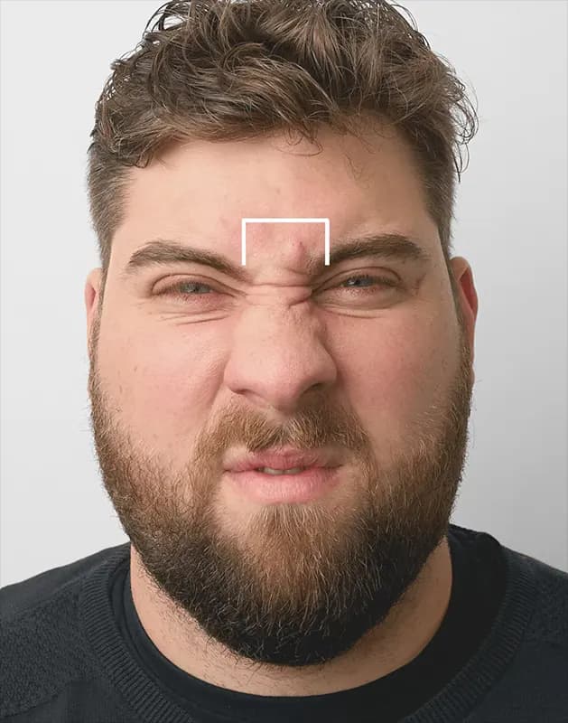 Between the eyebrows Between the eyebrows