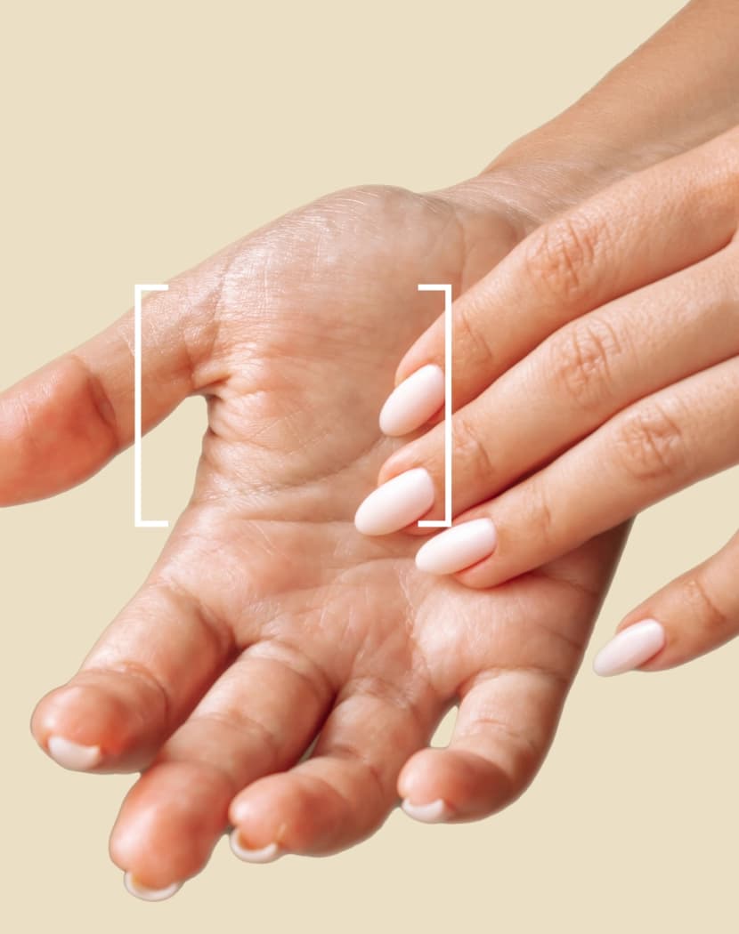 Excessive Sweating Hands Excessive Sweating Hands