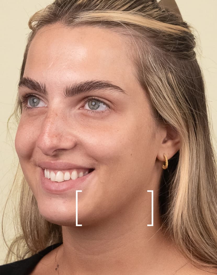 Jawline Slimming Jawline Slimming