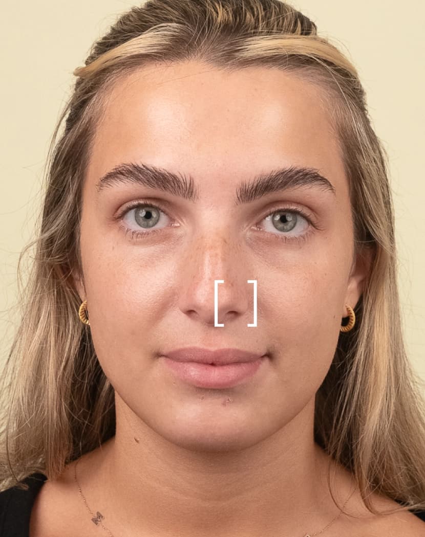 Nose Flare Nose Flare