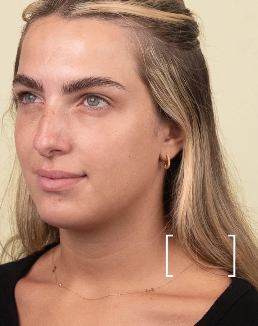 Trapeze Muscle Trapeze Muscle