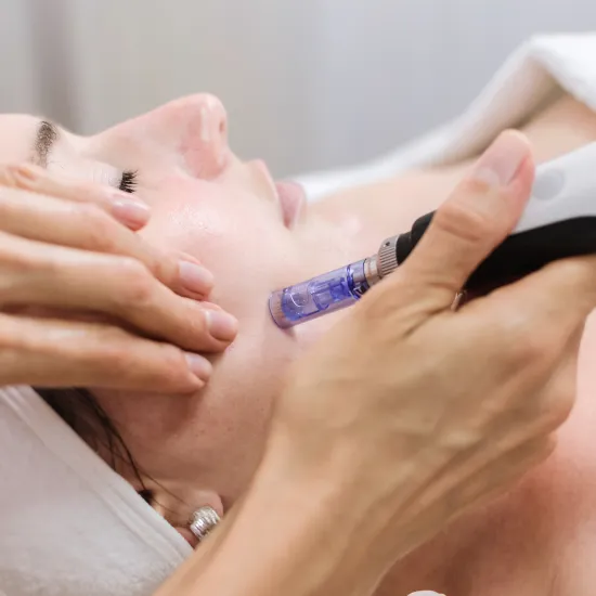 The Multiple Benefits Of Microneedling The Multiple Benefits Of Microneedling