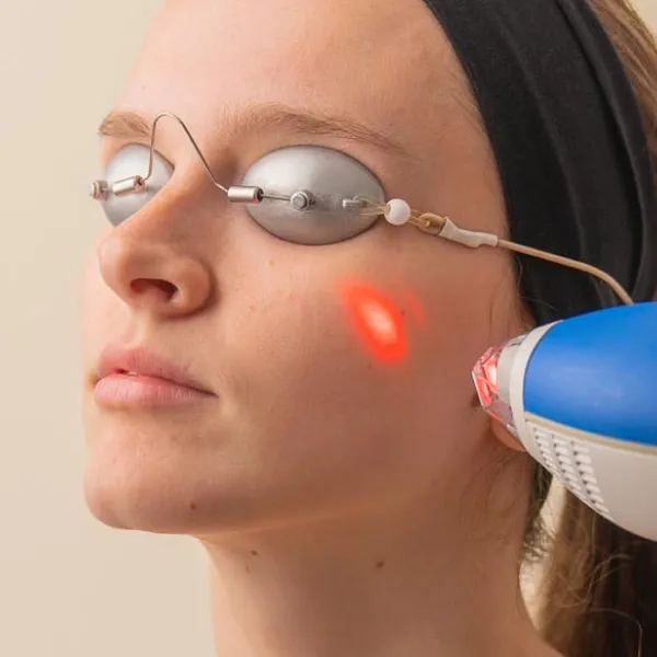 Laser Facial