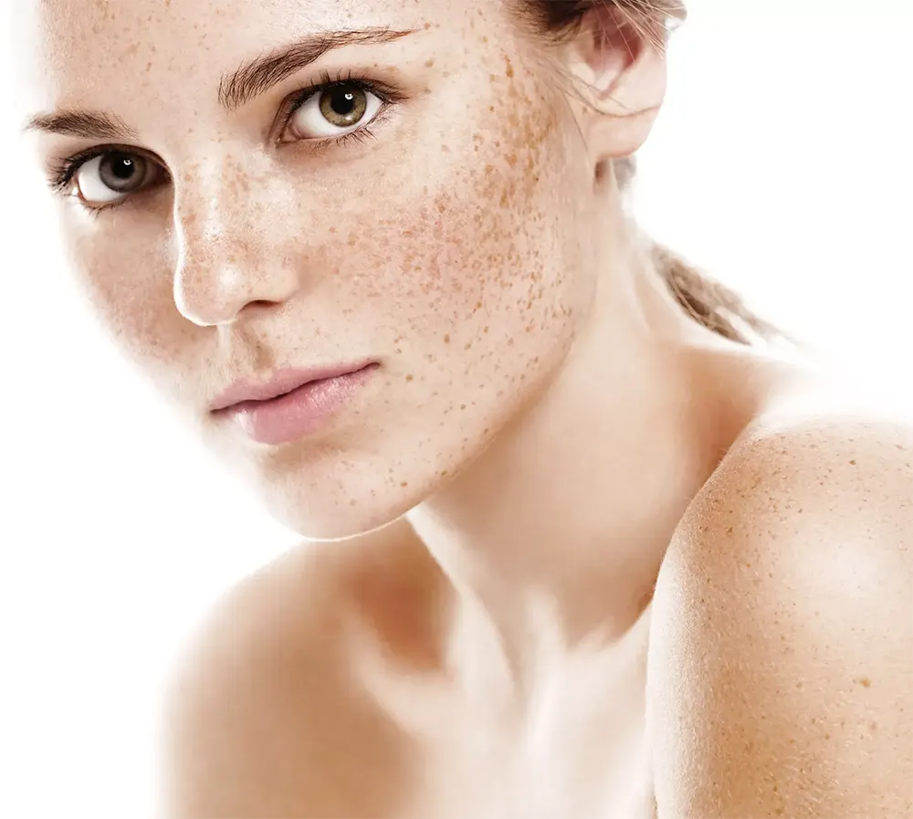 Pigmentation & Sun Damage Pigmentation & Sun Damage