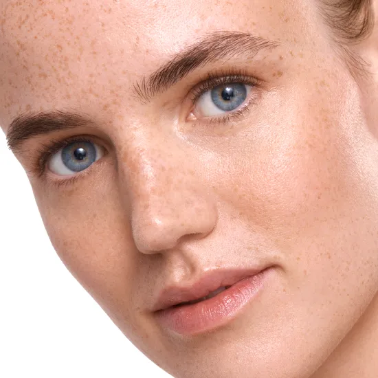 Redness & Sensitivity Redness & Sensitivity