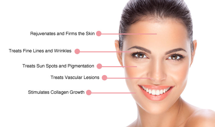 Laser 360 - Skin rejuvenation treatment