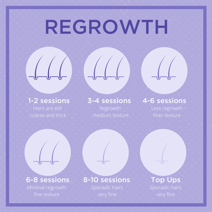 A diagram demonstrating hair regrowth following laser hair removal. It shows how each treatment reduces the number of hairs and their thickness